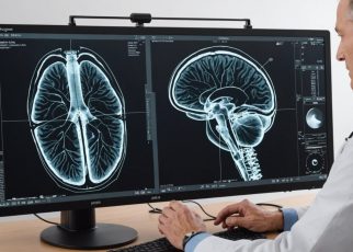Radiographie vs IRM : quelles différences entre ces deux techniques d'imagerie médicale ?